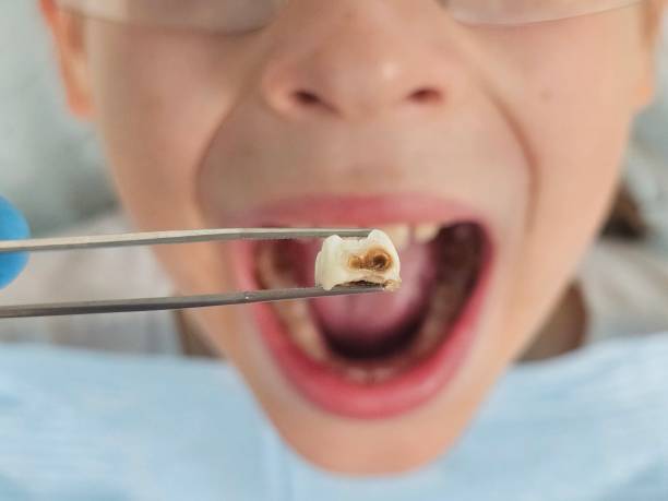 Best Urgent Dental Care  in Forest, MS